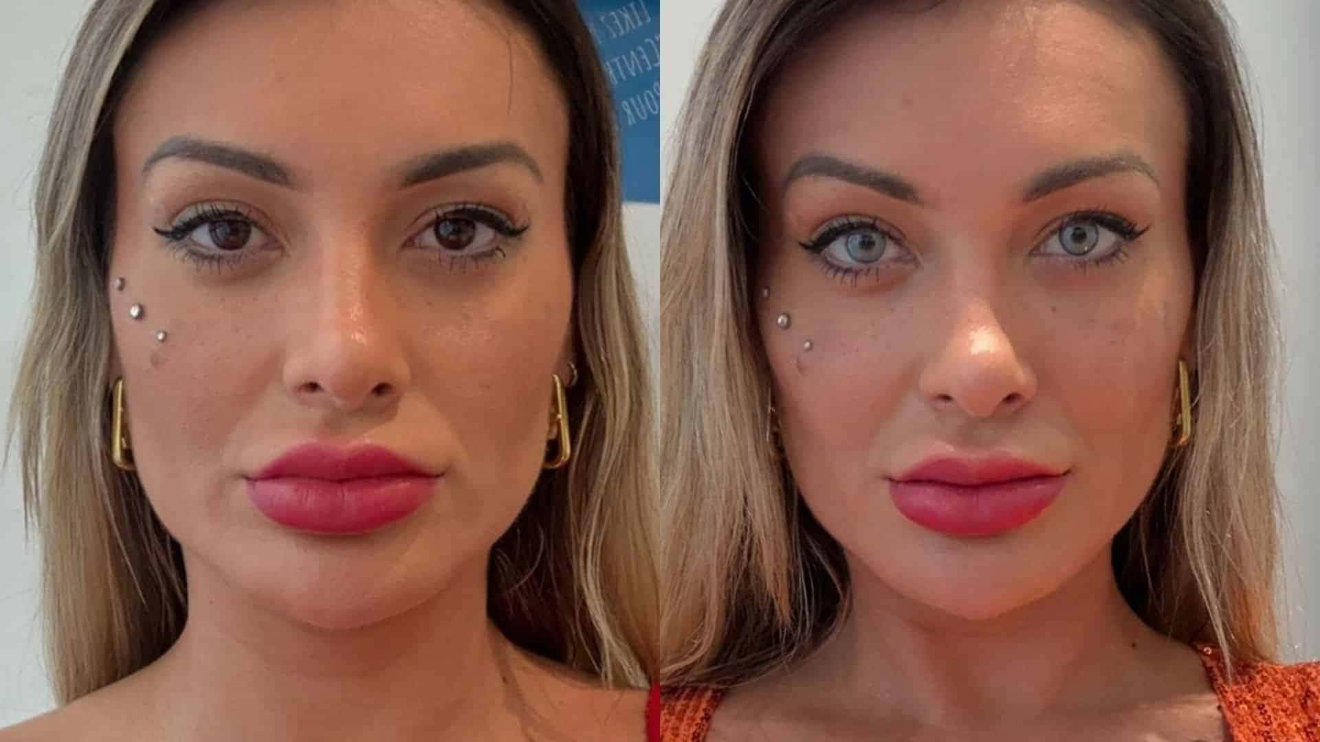 antes-e-depois-andressa-urach-1