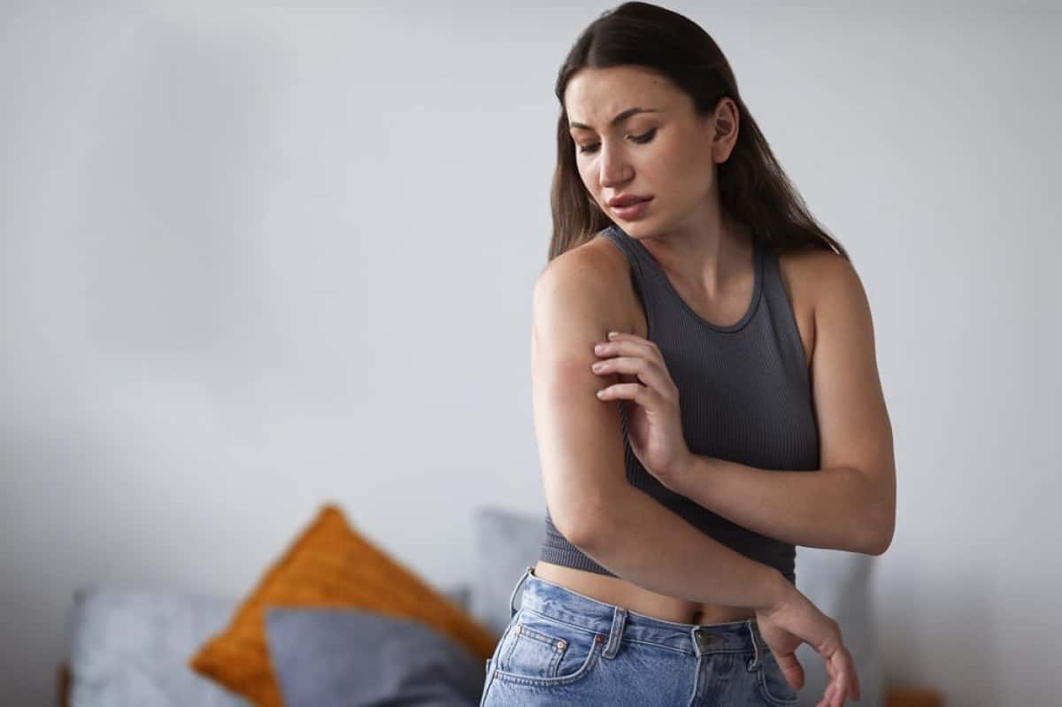 woman-suffering-from-rash