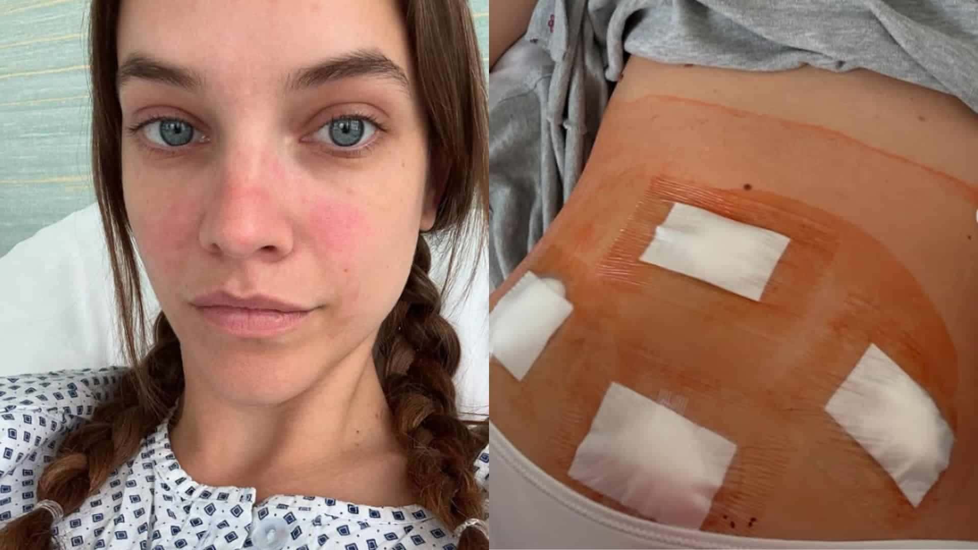 Barbara-Palvin-Endometriose