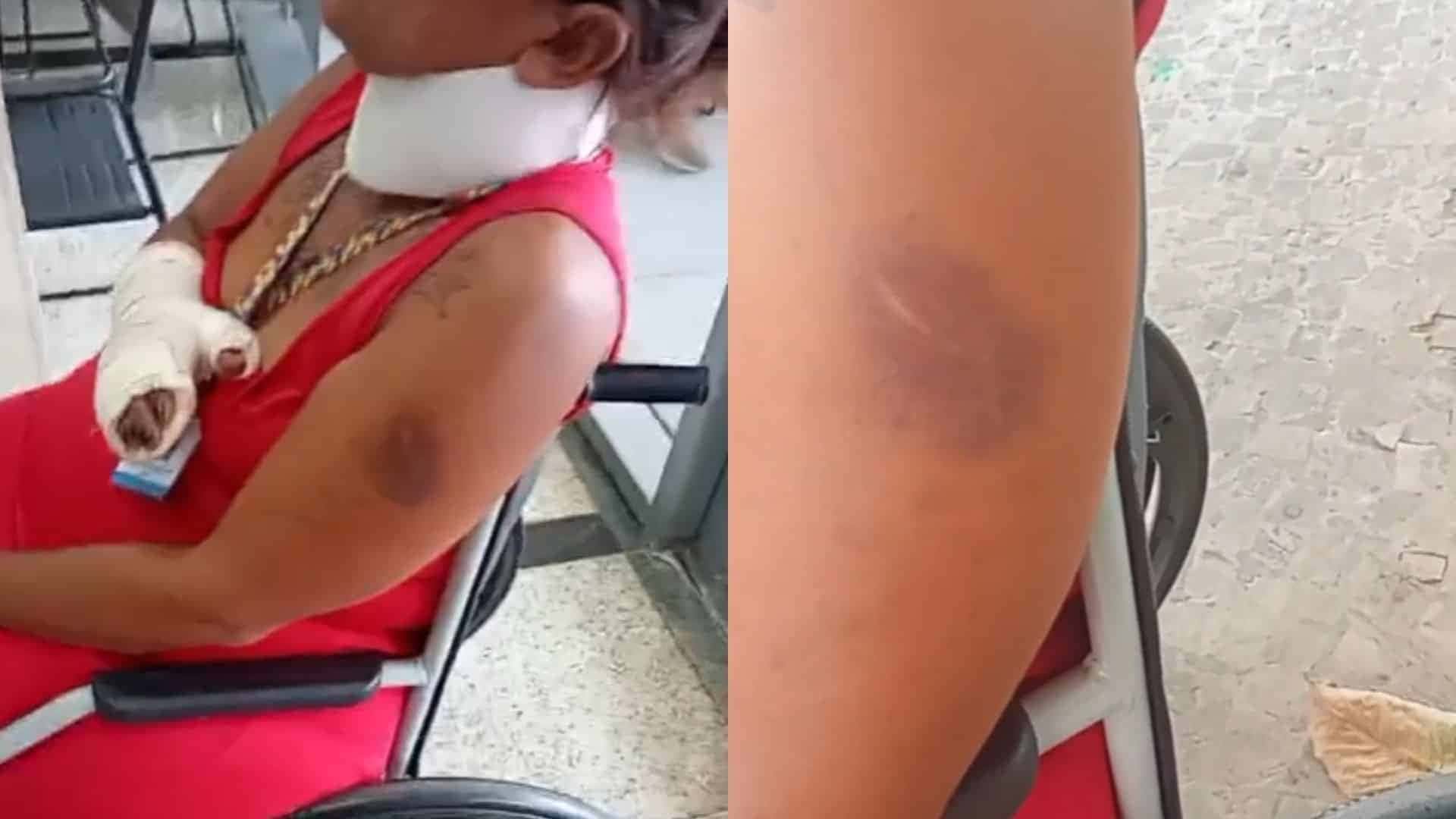 gcm-baleado-sp-5