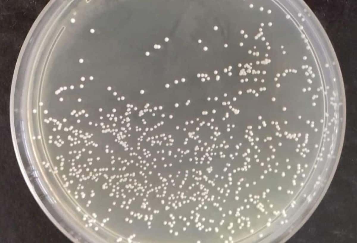 probiotico_asma_fapesp