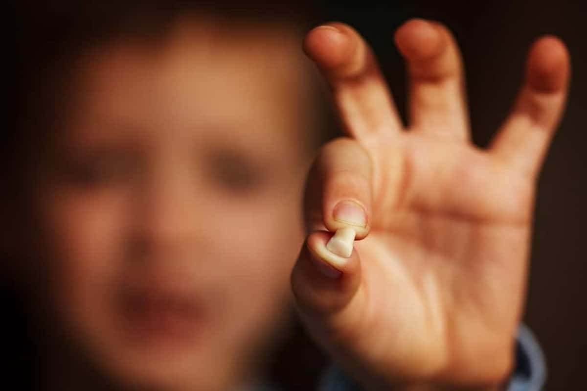 Kids Hand with one milk tooth. First tooth lost