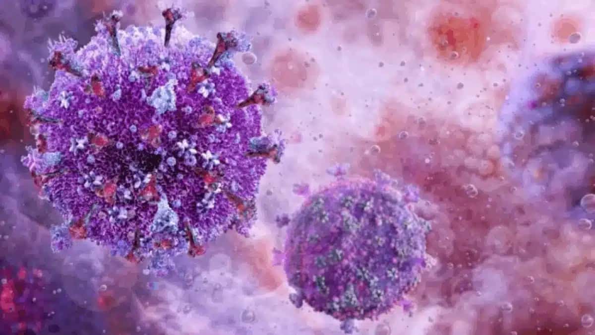 HIV-848×477-1