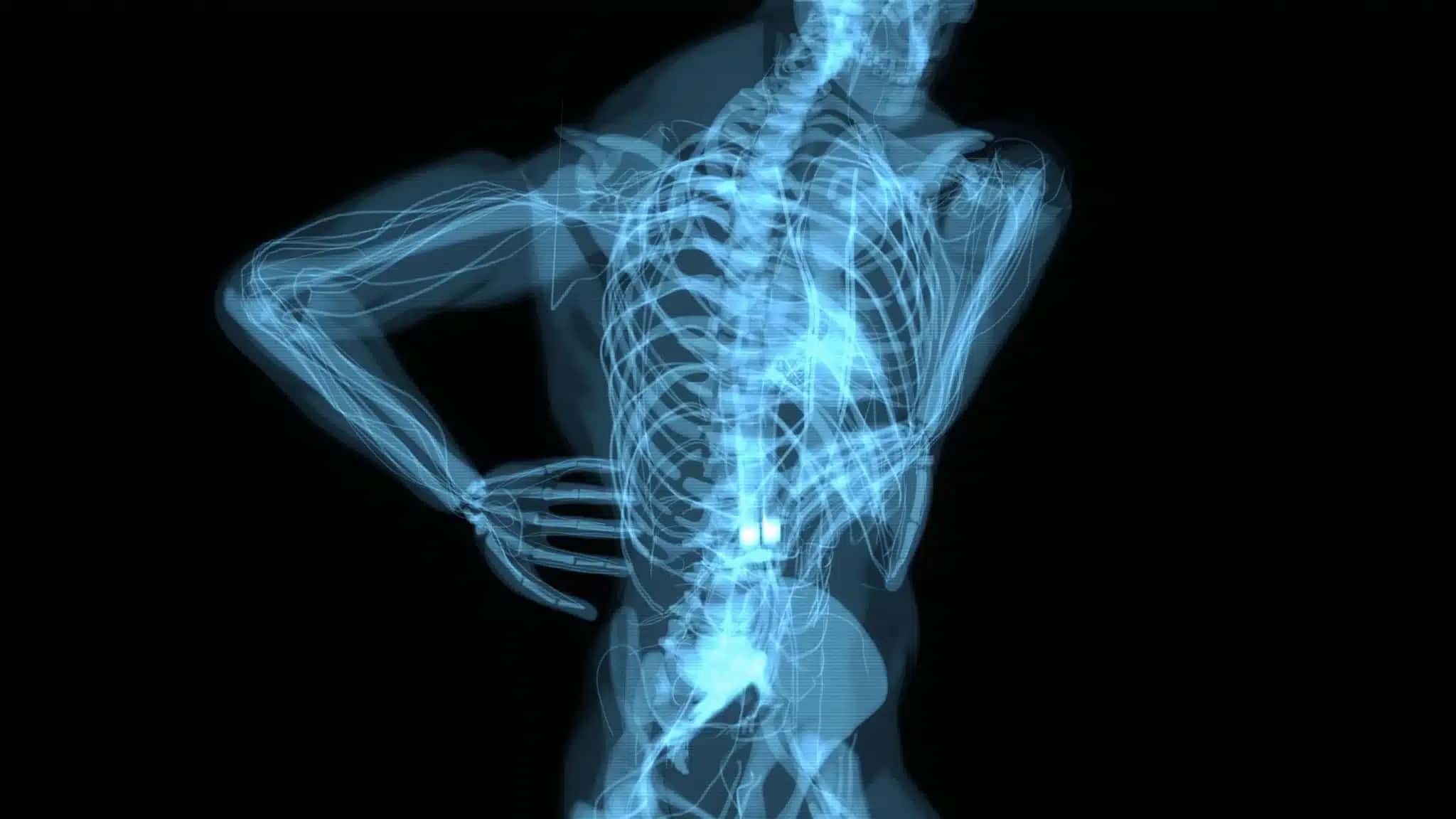 abstract-3d-motion-design-backpain