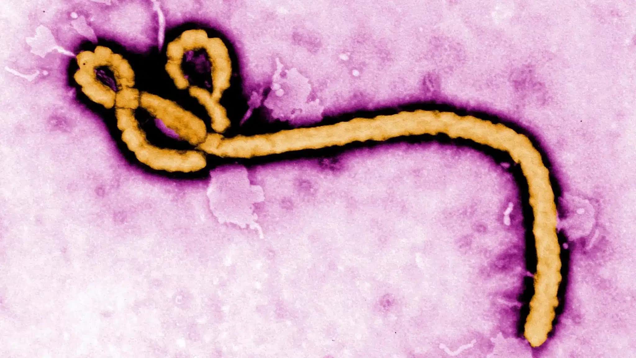 ebola_8a4b8f-e1780151831891-2