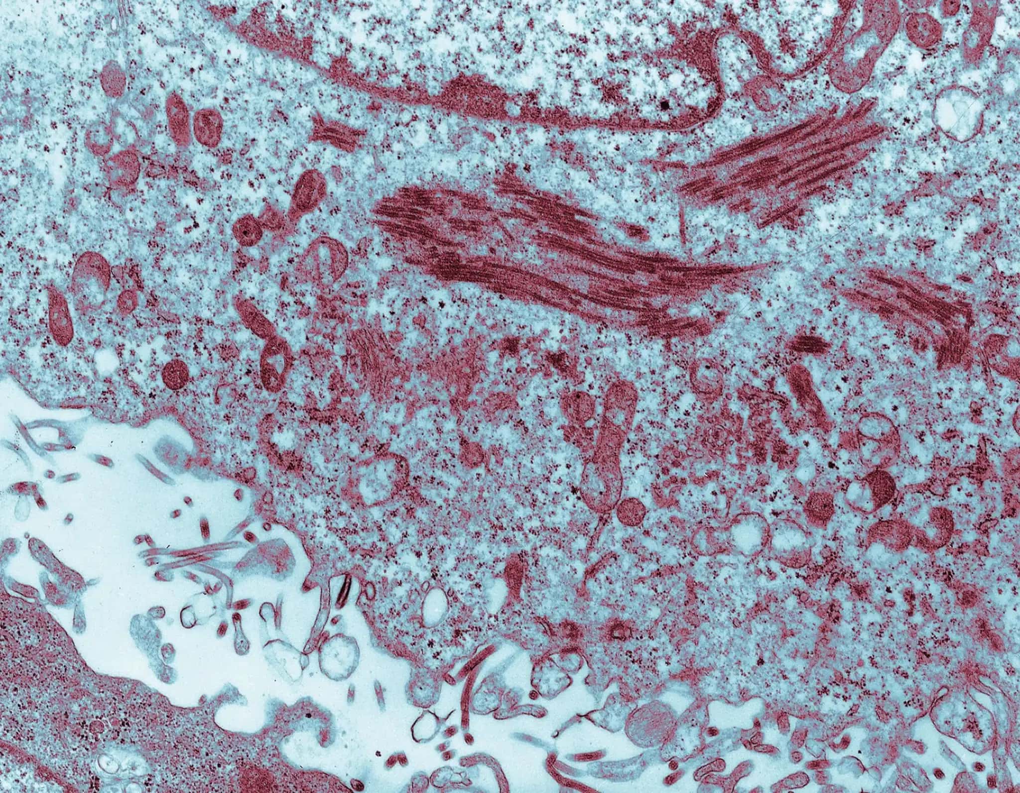 ebola-2