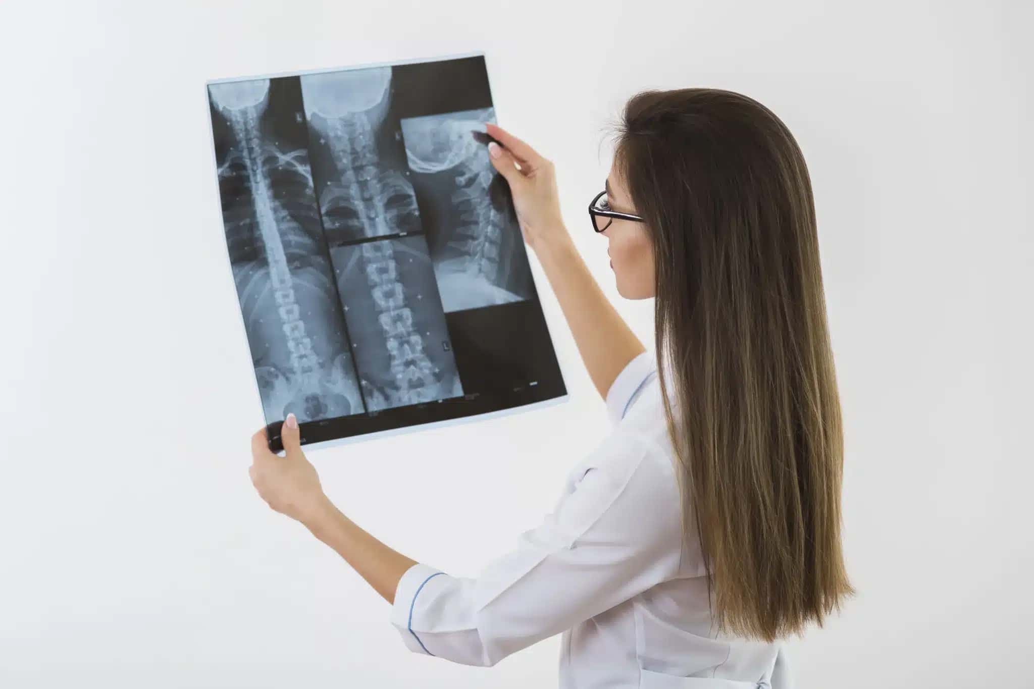radiografia-radiacao-medo-paciente