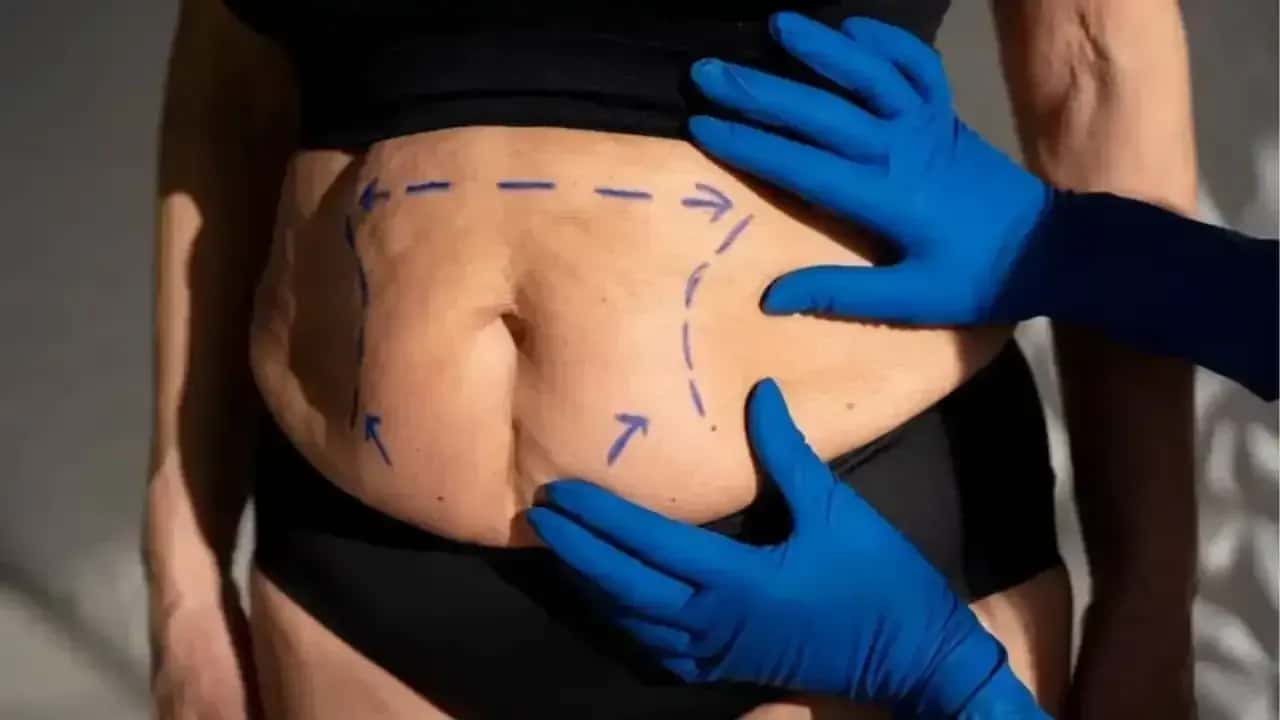Ilustração de cirurgia plástica