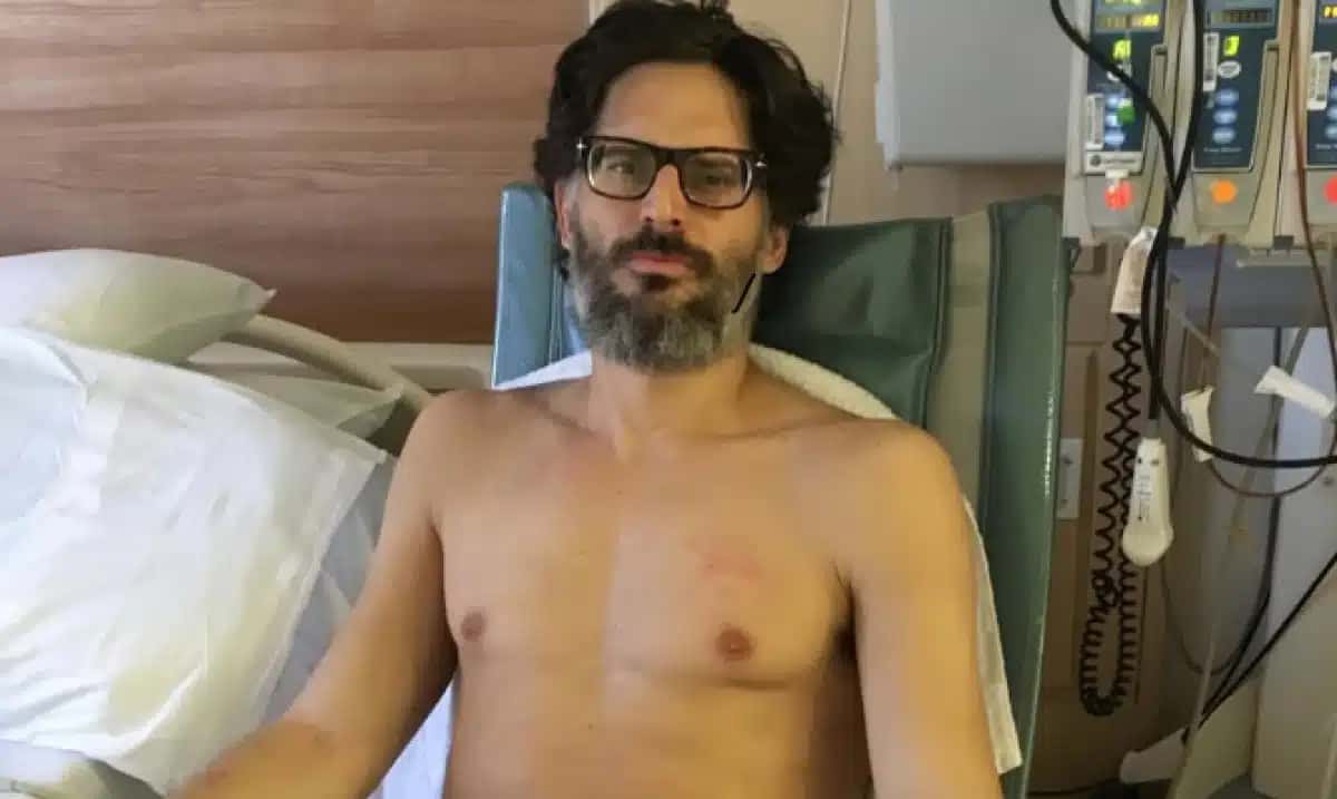 Joe Manganiello revela detalhes de sua recuperação após uma cirurgia delicada.