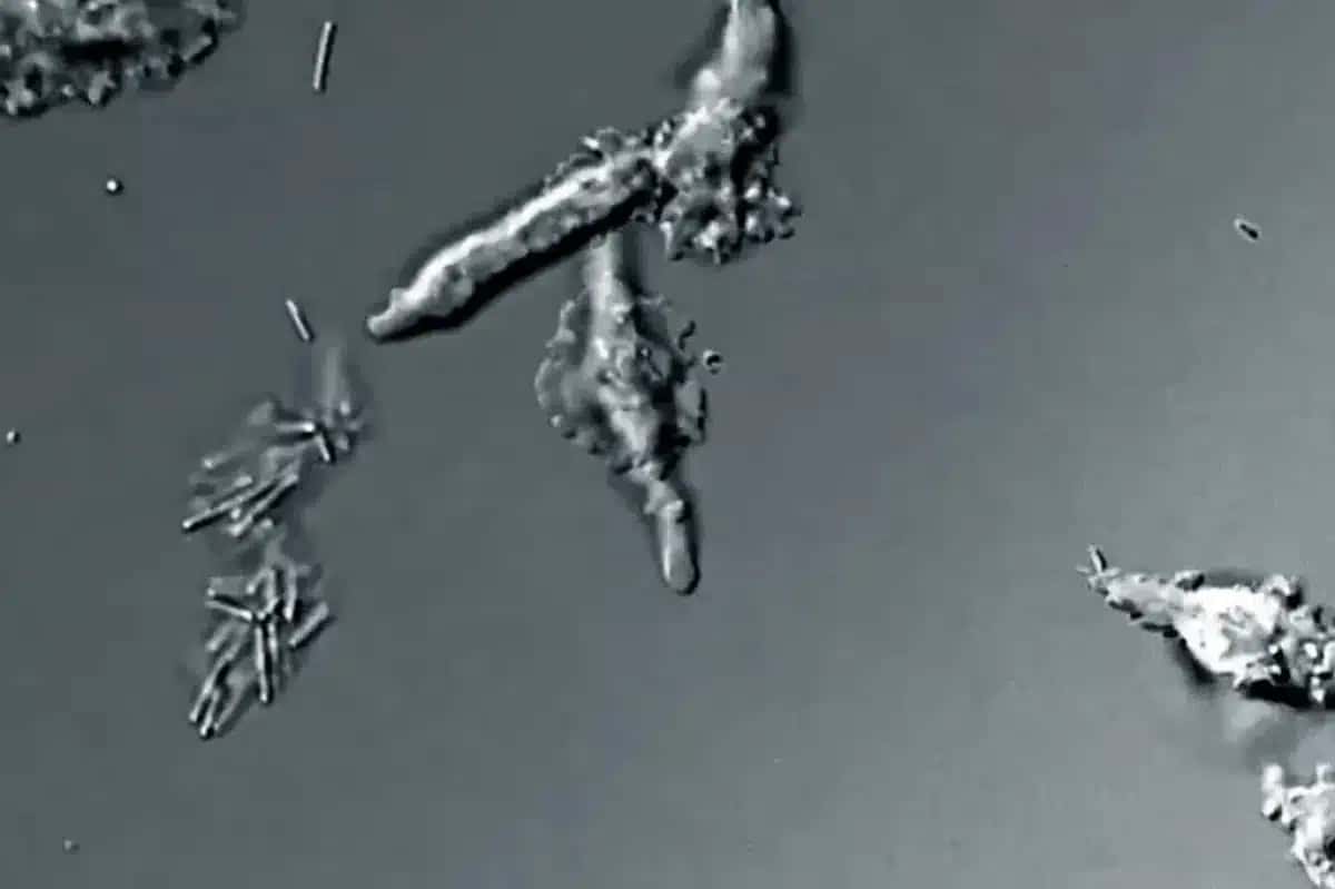 Microscopia de bactérias em forma de bastonetes e aglomerados irregulares, flutuando em um fundo cinza-escuro | Foto: Reprodução/Superinteressante