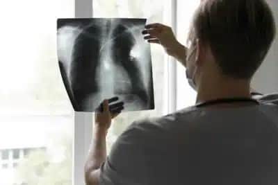 Anvisa aprova terapia para câncer de pulmão avançado; Brasil é o 2º país a liberá-la
