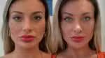 Andressa Urach relata sentir dor após alterar a cor dos olhos: “Arrependida”
