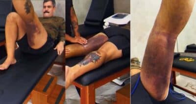 Imagem card com fundo