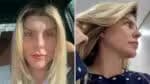 Íris, ex-participante do Big Brother Brasil, revela alterações faciais após série de procedimentos cirúrgicos; veja