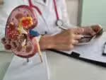 O câncer renal deverá aumentar em cerca de 80&percnt; no Brasil e na América Latina até o ano de 2050