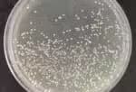 Como identificar os sinais de que seu intestino precisa de auxílio e como selecionar um probiótico