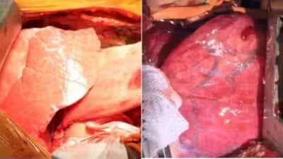 Imagem card com fundo