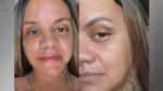 Mulher que sofreu agressão com 61 golpes revela seu rosto após um mês