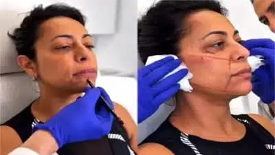 Imagem card com fundo