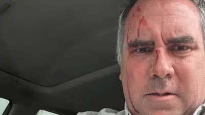 Imagem card com fundo