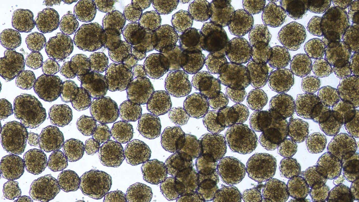 celulas-de-ilhotas-humanas-criadas-em-laboratorio