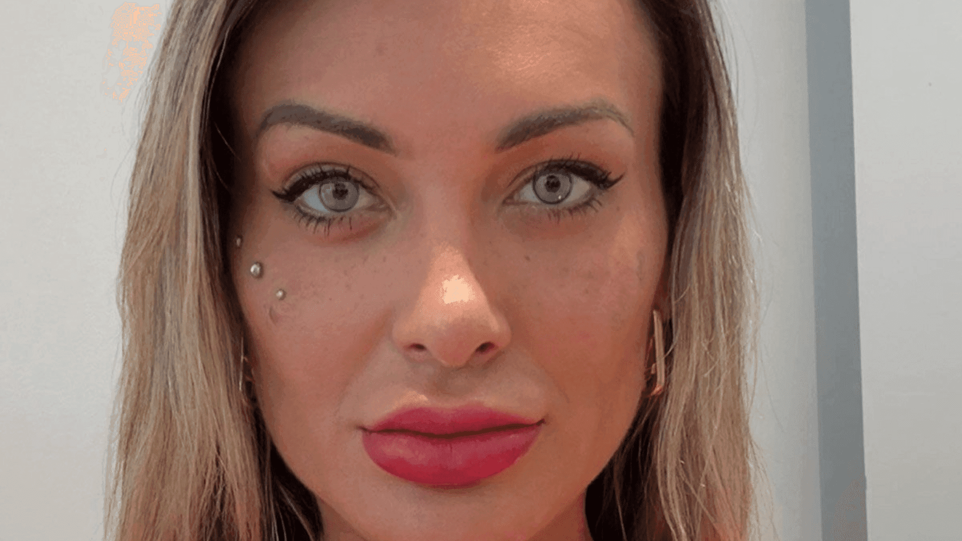 andressa-urach-muda-cor-dos-olhos-na-europa-e-especialista-alerta-para-riscos-graves