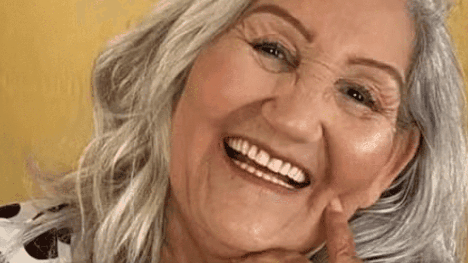 Mulher-morre-13-dias-depois-de-ter-rosto-‘desfigurado-em-tentativa-de-feminicidio