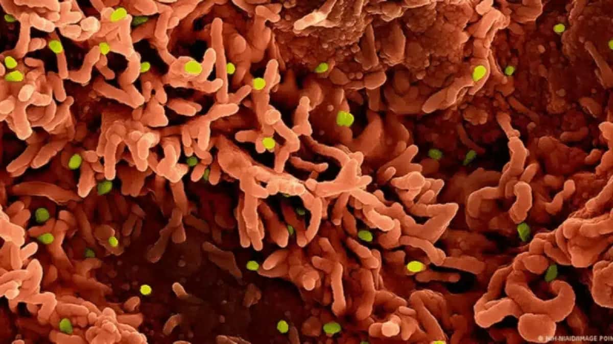 Apos-o-Carnaval-veja-quais-sao-os-virus-que-podem-criar-novas-crises-em-2026-800×450-1