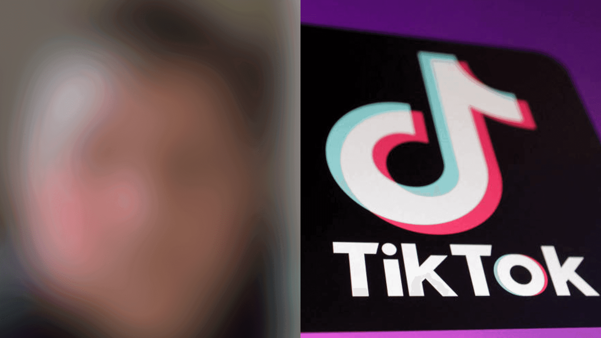 Menino-de-9-anos-fica-com-o-rosto-deformado-apos-fazer-desafio-no-TikTok