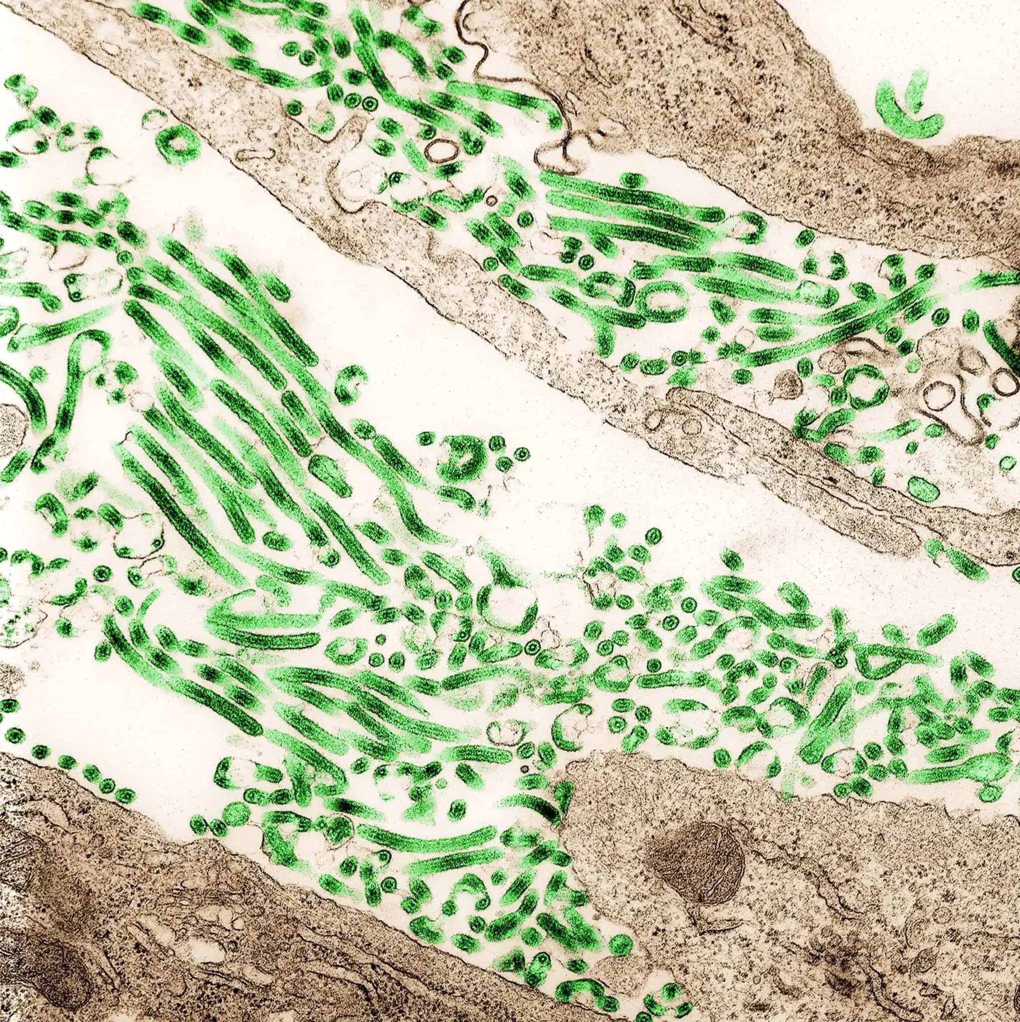 ebola-1