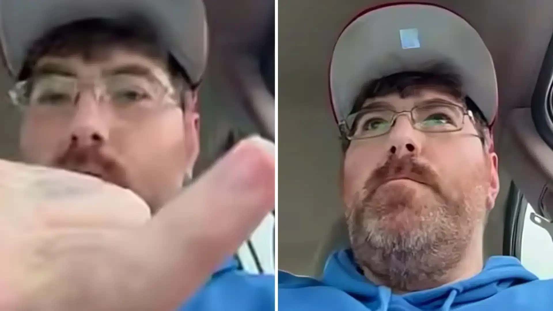 Homem com o menor pênis do mundo passa por procedimento nos EUA e relata alívio