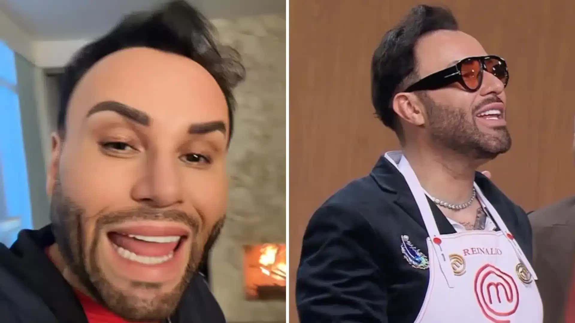 MasterChef: participante desiste após picada; veja riscos e sintomas