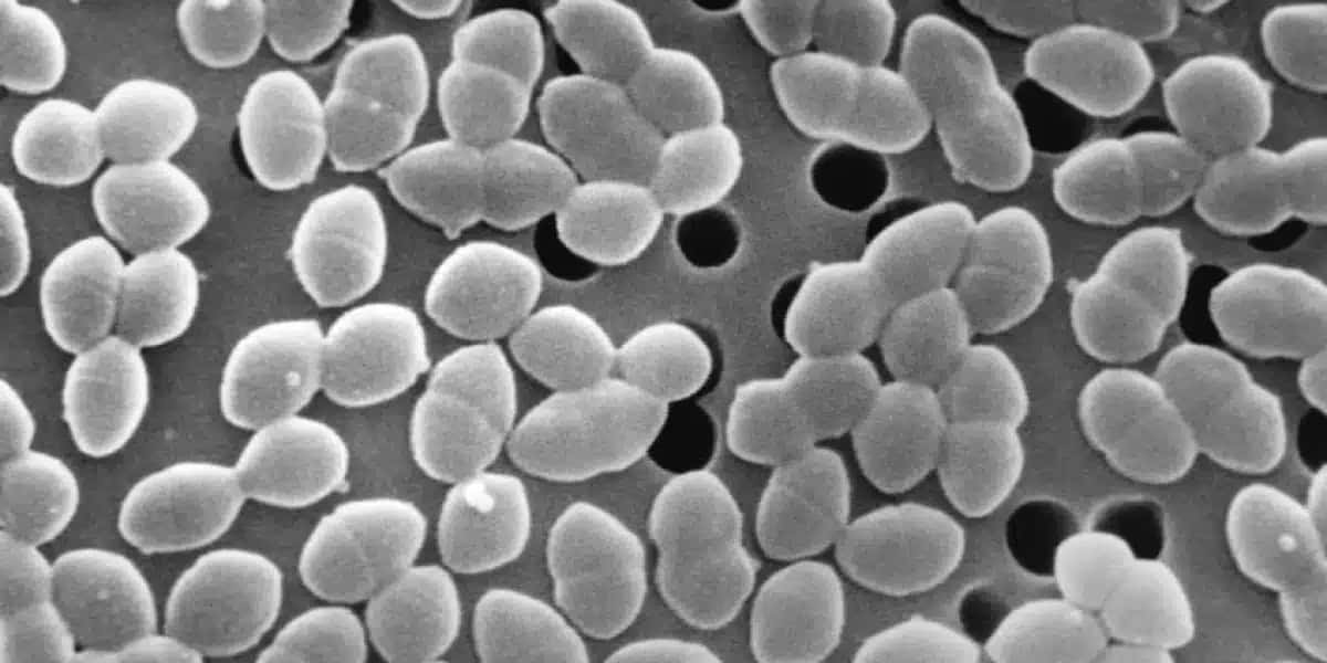 O tratamento com antibióticos, combinado com uma dieta rica em açúcar, exacerbou e prolongou a proliferação da bactéria Enterococcus faecium no intestino dos pacientes