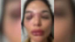 Dentista registra boletim de ocorrência contra marido empresário por agressões em São Paulo