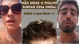 Piolhos atingem filhos de Luana Piovani e Pedro Scooby; quais são os riscos?
