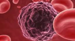 2,5 milhões de casos de câncer em 2026 têm origem em infecções, diz OMS